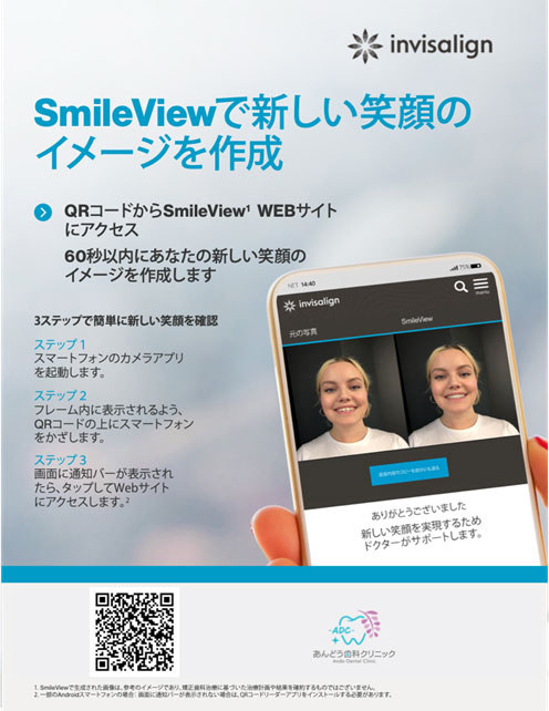 SmileView